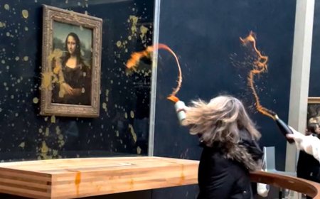 УУР АМЬСГАЛЫН ӨӨРЧЛӨЛТТЭЙ ТЭМЦЭГЧИД “МОНА ЛИЗА” ЗУРАГ РУУ ШӨЛ ЦАЦЖЭЭ