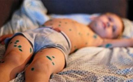 “САЛХИН ЦЭЦЭГ ХҮНДЭРВЭЛ АРЬСНЫ ИДЭЭТ ҮРЭВСЭЛ, УУШГИНЫ ХАТГАЛГАА ҮҮСДЭГ"