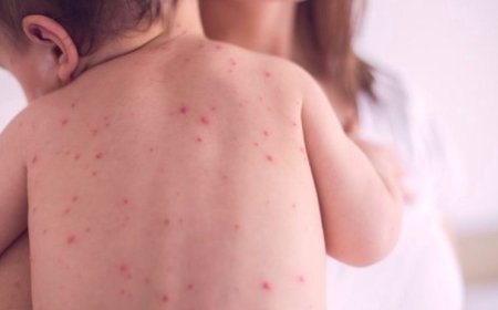 УЛААНБУРХАН ӨВЧНИЙ 907 ТОХИОЛДОЛ БҮРТГЭГДЭЭД БАЙНА