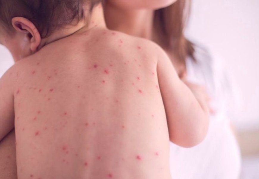 УЛААНБУРХАН ӨВЧНИЙ 907 ТОХИОЛДОЛ БҮРТГЭГДЭЭД БАЙНА