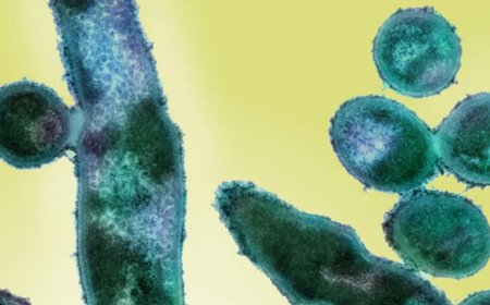 ГЕРМАНД БҮРЭН АРИЛСАН ГЭЖ ҮЗЭГДЭЖ БАЙСАН САХУУ ӨВЧИН ДАХИН ТАРХАЖ ЭХЭЛЛЭЭ