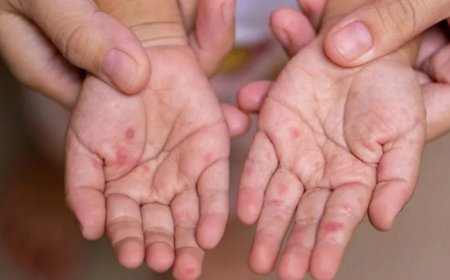 УЛААНБУРХАН ӨВЧНИЙ БАТЛАГДСАН ТОХИОЛДОЛ 6265 БОЛЖЭЭ