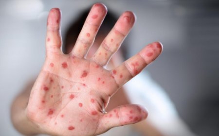 ЗАСГИЙН ГАЗРЫН НӨӨЦ САНГААС ТАВАН ТЭРБУМ ТӨГРӨГ ГАРГАЖ, УЛААНБУРХАН ӨВЧИНТЭЙ ТЭМЦЭНЭ