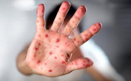 УЛААНБУРХАН ӨВЧНИЙ НИЙТ БАТЛАГДСАН ТОХИОЛДОЛ 13.663 БОЛЖЭЭ