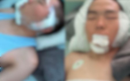 0132 ДУГААР АНГИД АЛБА ХААЖ БАЙСАН БАЙЛДАГЧИЙН БИЕИЙН БАЙДАЛ МАШ ХҮНД БАЙНА ГЭВ
